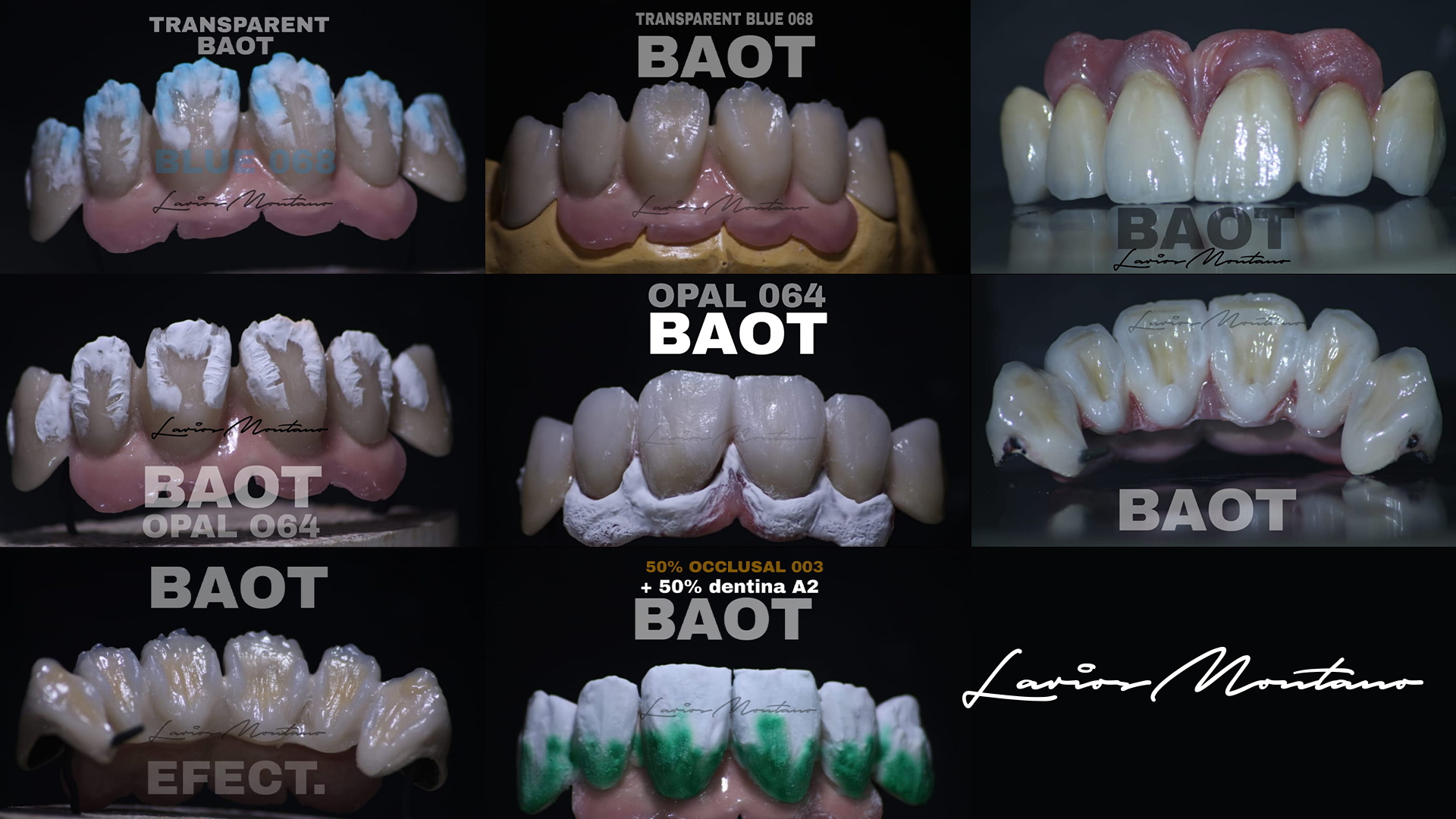 dental material for zirconia porcelain teeth