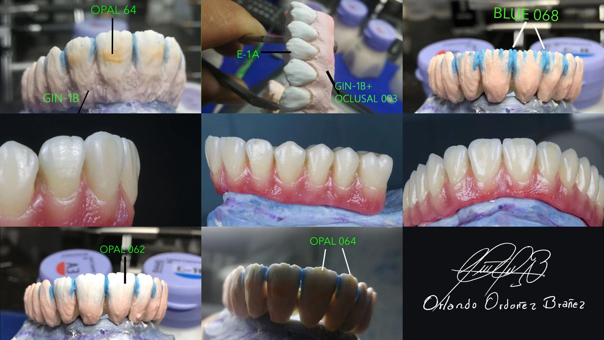 occlusal dental zirconium ceramic powder