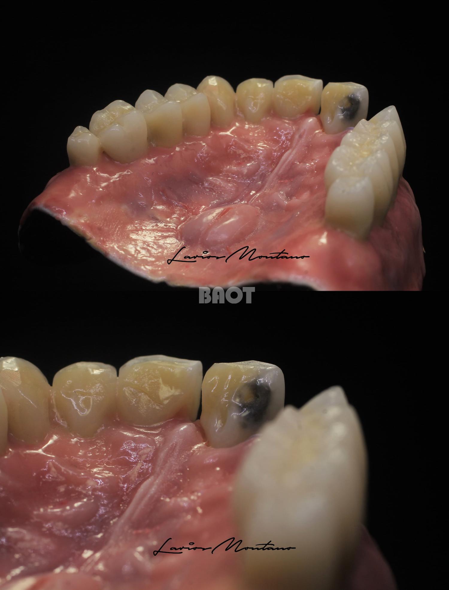 Enamel Gingiva Porcelain Powder Dental Lab Material