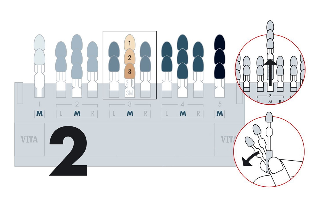 Dental porcelain denture shade guide